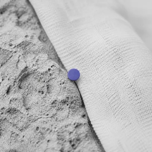 Questionnaire de santé et assurance emprunteur : ce qu'il faut déclarer, ce que vous pouvez taire légalement